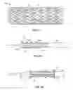 Fig. 02 - Method and apparatus for reducing stress during stent manufacture