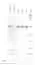 Fig. 01 - Use of hydrophobin as a phase stabilizer