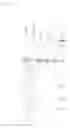 Fig. 02 - Use of hydrophobin as a phase stabilizer