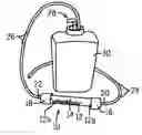 Fig. 01 - Gas scrubber for automated clinical analyzer