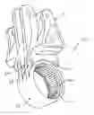 Fig. 01 - Composite ring gear with metallic gear insert, and method of forming same