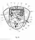 Fig. 13 - Fluid-product dispensing device