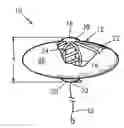 Fig. 01 - Vaginal pessary