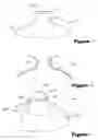 Fig. 03 - DEVICE FOR PROTECTING A NIPPLE OF A MOTHER DURING NURSING