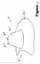 Fig. 04 - DEVICE FOR PROTECTING A NIPPLE OF A MOTHER DURING NURSING