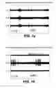 Fig. 02 - Microelectrode array system with integrated reference microelectrodes to reduce detected electrical noise and improve selectivity of activation