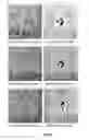 Fig. 07 - Extended electron tomography