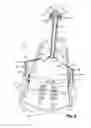 Fig. 07 - Rope tensioner for winch