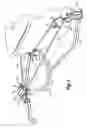 Fig. 04 - Rope tensioner for winch