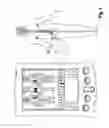 Fig. 04 - Handheld device for a patient