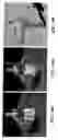 Fig. 16 - Systems, methods and devices for motion capture using video imaging
