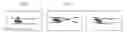 Fig. 01 - Cascade analysis for intestinal contraction detection