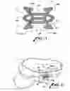 Fig. 02 - EYEGLASS SUPPORT DEVICE