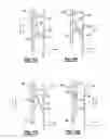 Fig. 08 - Fluid reservoir wiper assembly