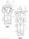 Fig. 09 - Fluid reservoir wiper assembly