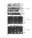 Fig. 02 - Aberrant expression of CKS1 and CKS2 and uses thereof