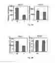 Fig. 06 - Aberrant expression of CKS1 and CKS2 and uses thereof
