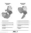 Fig. 09 - HER2 antibody composition