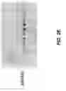 Fig. 07 - METHODS FOR TREATING PATHOLOGICAL NEOVASCULARIZATION