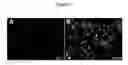 Fig. 02 - Dried reconstituted vesicle formation for pharmaceutical application