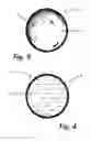 Fig. 04 - METHODS FOR DENDRITIC CELL THERAPY USING PHARMACOLOGICALLY ACTIVE MICROCARRIERS