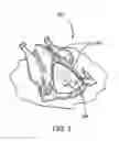 Fig. 03 - VALUE WHOLE POULTRY PRODUCT AND METHOD FOR MANUFACTURE