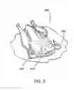 Fig. 04 - VALUE WHOLE POULTRY PRODUCT AND METHOD FOR MANUFACTURE