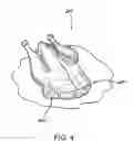 Fig. 05 - VALUE WHOLE POULTRY PRODUCT AND METHOD FOR MANUFACTURE