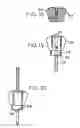 Fig. 06 - Dental implant drill apparatus and method
