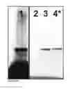 Fig. 02 - Methods for controlling amplification