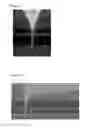 Fig. 09 - Microinjection method and device