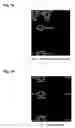 Fig. 19 - Oligonucleotide for Detection of Bacteria Associated with Sepsis and Microarrays and Method for Detection of the Bacteria Using the Oligonucleotide
