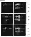 Fig. 49 - Modified cupredoxin derived peptides