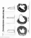 Fig. 07 - Remedies for ischemia