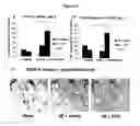 Fig. 19 - Remedies for ischemia