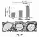 Fig. 03 - Methods for improving the structure and function of arterioles