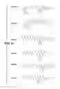 Fig. 08 - INHIBITION OF ALPHA-SYNUCLEIN AGGREGATION