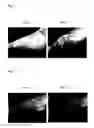 Fig. 02 - Potentiator of radiation therapy