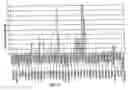 Fig. 10 - NOVEL NUCLEOTIDE AND AMINO ACID SEQUENCES, AND ASSAYS AND METHODS OF USE THEREOF FOR DIAGNOSIS OF BREAST CANCER