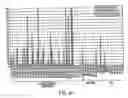 Fig. 40 - NOVEL NUCLEOTIDE AND AMINO ACID SEQUENCES, AND ASSAYS AND METHODS OF USE THEREOF FOR DIAGNOSIS OF BREAST CANCER