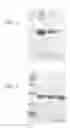 Fig. 06 - Method of purifying apolipoprotein A-1