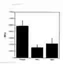 Fig. 08 - Metalloprotein inhibitors