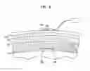 Fig. 08 - IMPLANTED-TRANSDUCER BONE CONDUCTION DEVICE