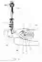 Fig. 04 - Access Systems and Methods of Intra-Abdominal Surgery