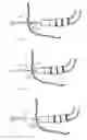 Fig. 06 - Access Systems and Methods of Intra-Abdominal Surgery