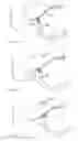 Fig. 15 - Access Systems and Methods of Intra-Abdominal Surgery