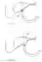 Fig. 16 - Access Systems and Methods of Intra-Abdominal Surgery