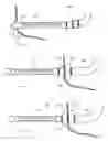 Fig. 23 - Access Systems and Methods of Intra-Abdominal Surgery