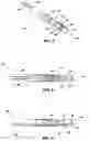 Fig. 03 - Method and apparatus for imaging within a living body