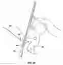 Fig. 16 - Method and apparatus for imaging within a living body